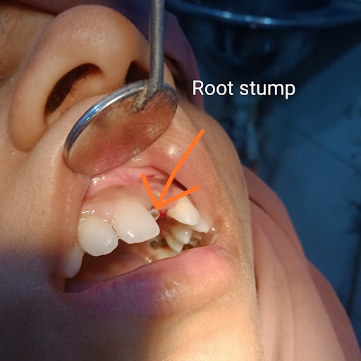 Smilex Dental Care & Implant Centre
