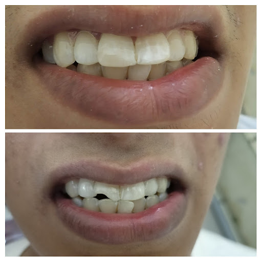 Lotus Dental Clinic