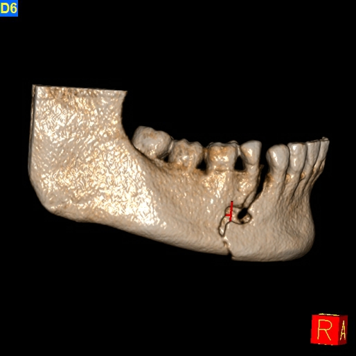 Gallery image 1