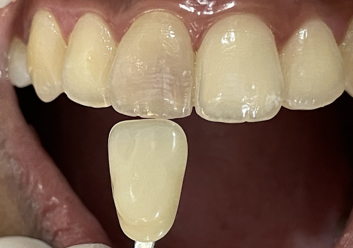 Smile Easy Dental Clinic
