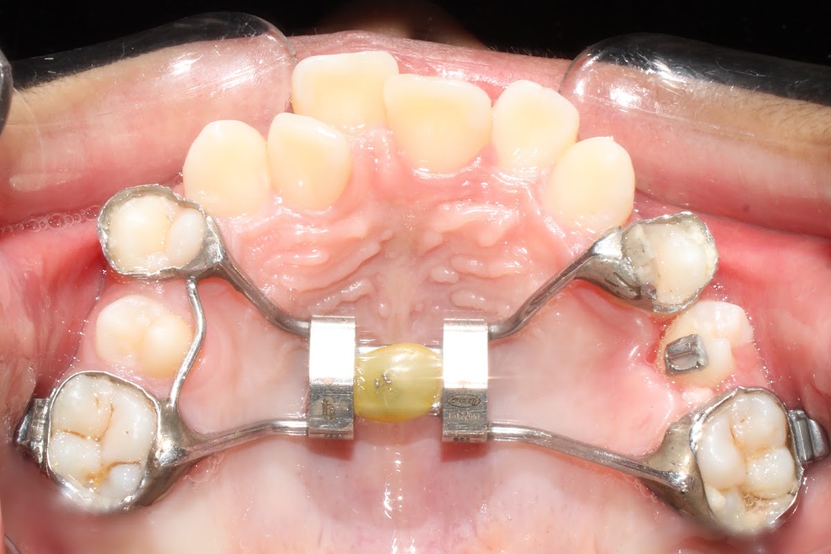 Dr Nikhil Jain Orthodontist Pune