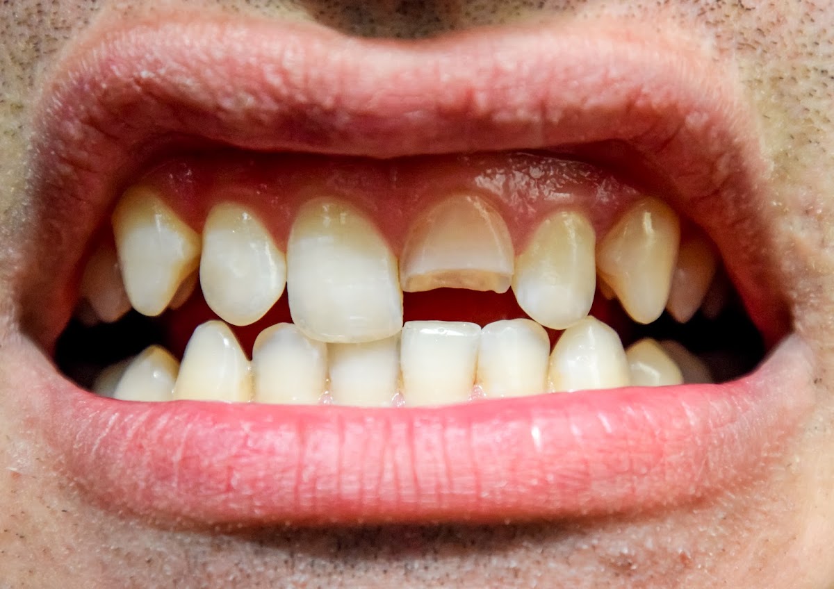 Dr. Pradeep Babu Kommi, 12+ yrs of Exp | Best Dentist in Nellore | RCT | Wisdom Teeth Removal
