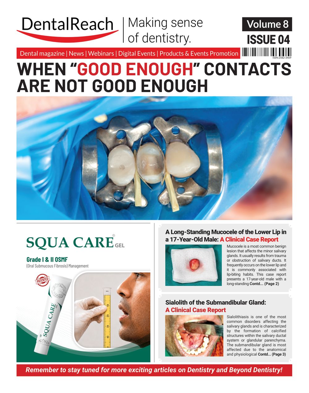 Cover of When “Good Enough” Contacts Are Not Good Enough