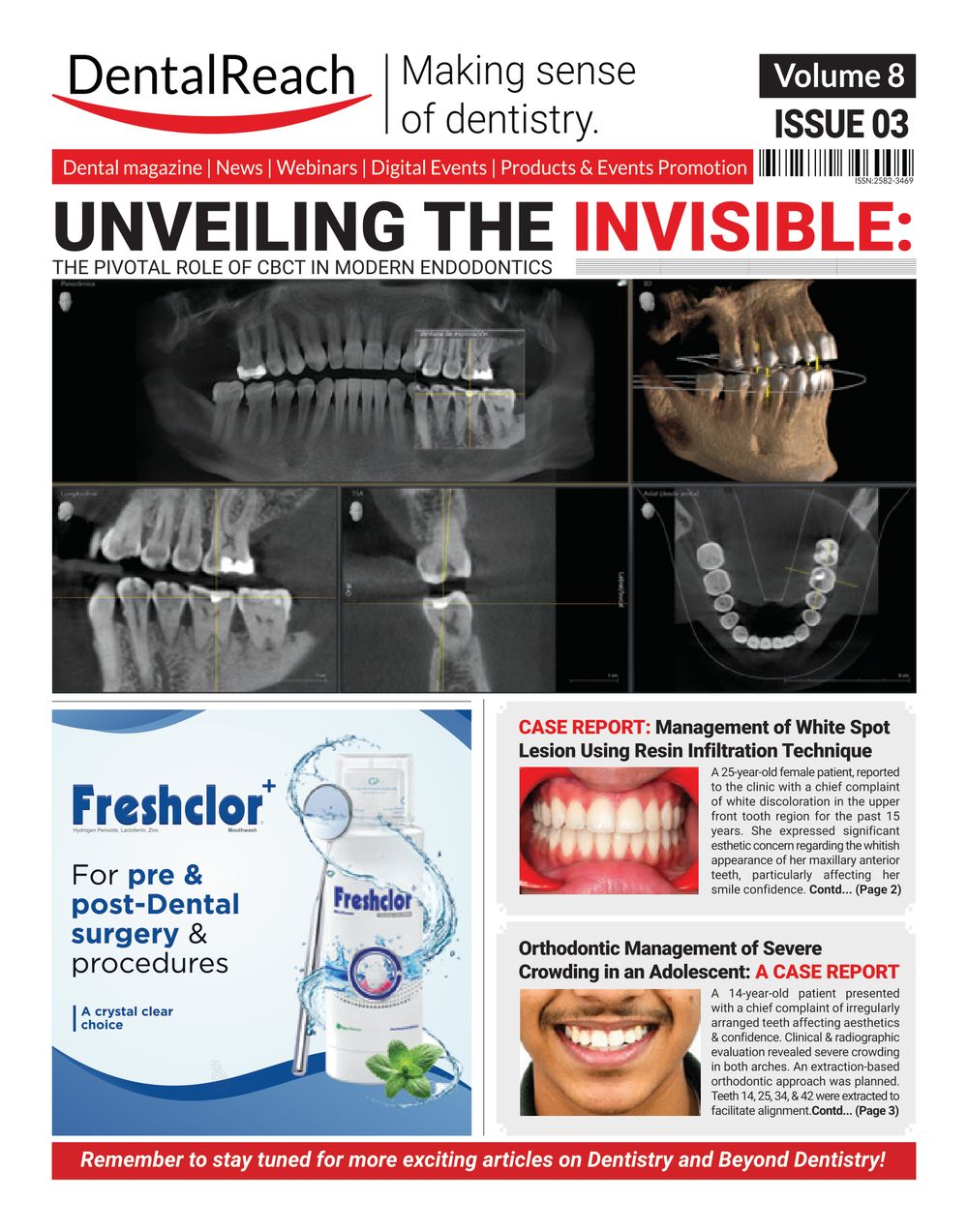 Cover of Unveiling the Invisible: The Pivotal Role of CBCT in Modern Endodontics