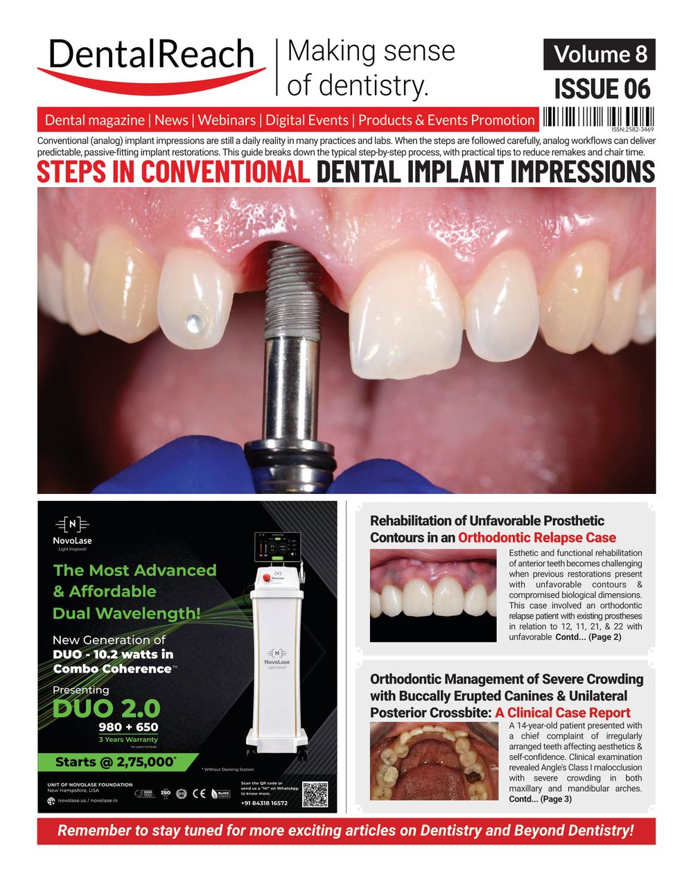 Cover of Steps in Conventional Dental Implant Impressions